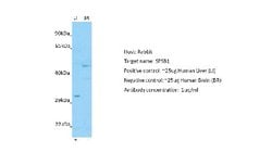 SPSB1 Antibody, Novus Biologicals 100 &mu;L; Unconjugated:Antibodies, Polyclonal